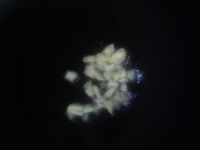 蒜炒豇豆